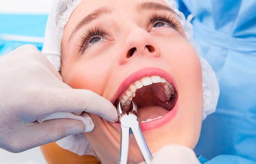 Показания к удалению зуба: