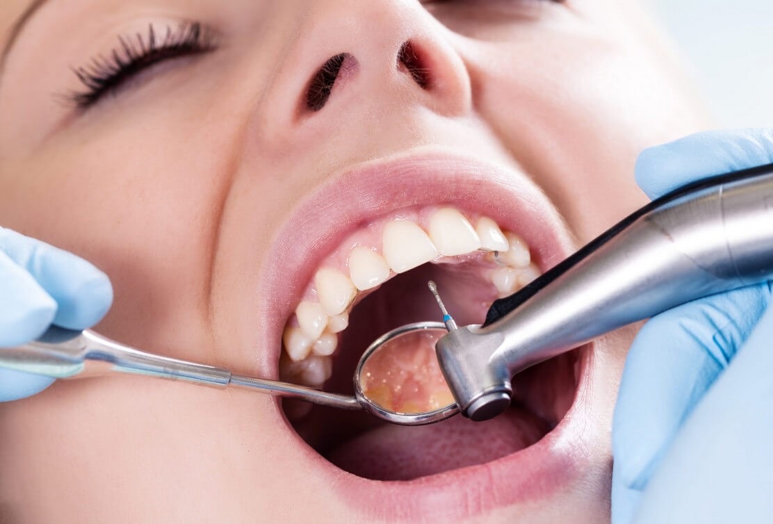 Современное лечение зубов